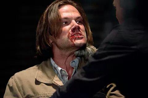 lithiumox's tweet photo. Poor Moose 😣 #SPNisBackIn4Days #SPN http://t.co/EmSY0VNKhe