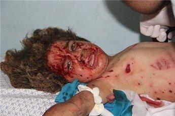 178kakapo's tweet photo. #AidGaza
2,104 deaths /600 underage, 500:woman
10 002 injured, missing o 300
Children r in need of mental treatment. http://t.co/KxMQ04zDwm
