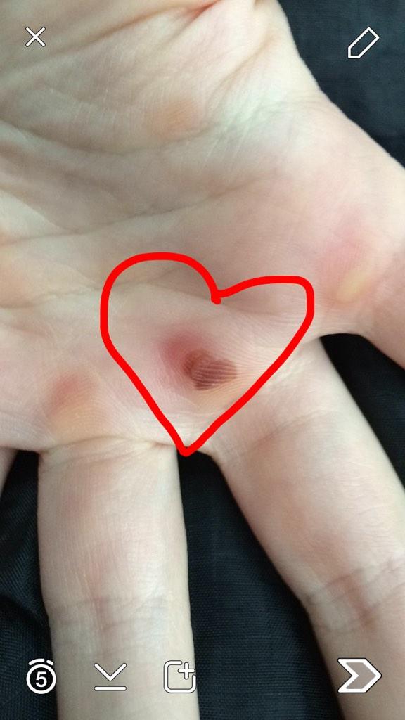 Must love rowing ❤️🚣  #rowingproblems <a href="/TheBitterRower/">Calluses n' Coxcalls</a> <a href="/Rowingproblem/">Rowing Problems</a>