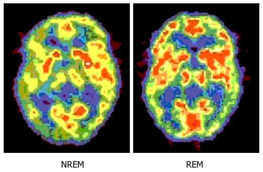 sportsleepcoach's tweet photo. #Brain activity in #REM & #NonREM #sleep. Read about the importance of sleep in #sport here http://t.co/8Ls3L5UmQq http://t.co/UxeVG5JhQs