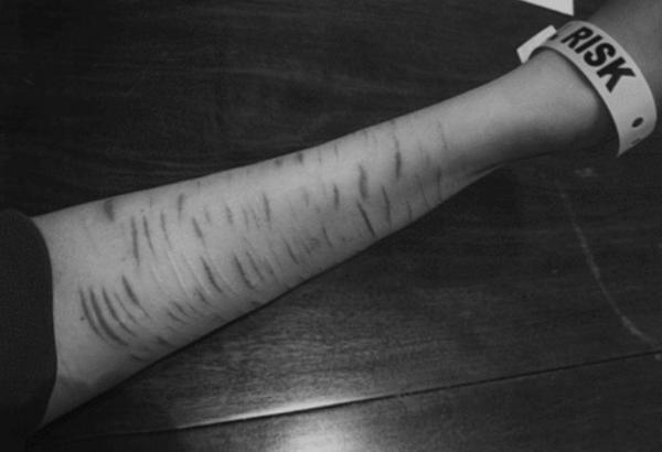 "<a href="/skinnnydream/">venus 𓂀</a>: "<a href="/autophobique/">13</a>: "She has smile on her face but scars on her wrists." ""