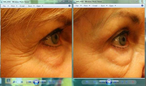 klasha66's tweet photo. #fillawrinkle
#overnight
#wrinklewarrior
#antiaging
#skincaresolutions
#beauty
#bestskin  http://t.co/HSEhL775QG http://t.co/Yc2eLNowc1