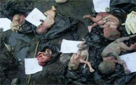 PresidentedeEsp's tweet image. MT @EspanaDeLuto El #aborto es un #genocidio FOTOS DE NIÑOS #ABORTADOS (no abrir personas sensibles) #AbortoLibre