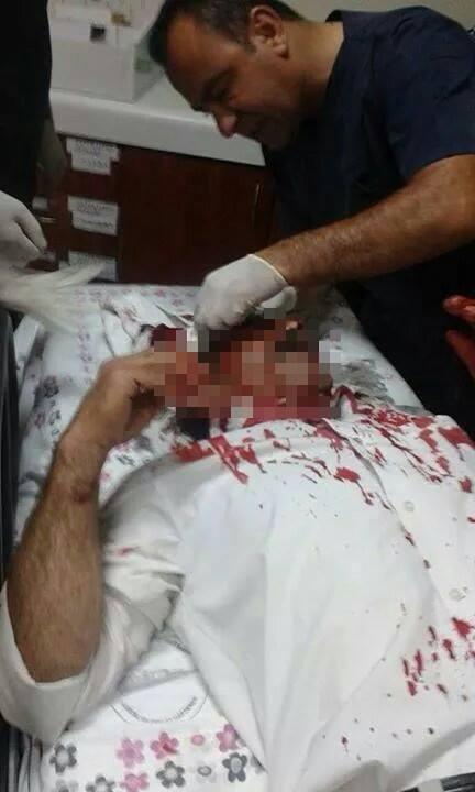 azadizm's tweet photo. ACİL.! Siirt'te devlet terörü yaşanıyor. #KobaneİcinSokağa http://t.co/lPawlCLKmP