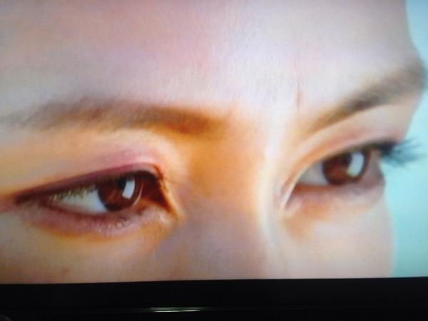 は ひ こ 木村佳乃さんの目頭切開がぱねぇ 目ん玉落ちたらどうすんだ Http T Co Rorhmkqtet Twitter は ひ こ 木村佳乃さんの目頭切開がぱねぇ 目ん玉落ちたらどうすんだ Http T Co Rorhmkqtet Twitter