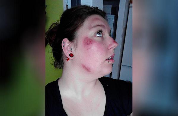 Vrouw van fiets getrapt en mishandeld in Heerhugowaard: 'Schrik van m'n leven' rtvnh.nl/nieuws/152600/…