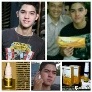 Sehat dn awet muda, al sudah ,yu open order WA : 08994405005 pin : 26677390 @ilkaniaku <a href="/iklan/">iklan</a> <a href="/apaajaiklan/">apaajaIKLAN</a> <a href="/iklan_oke/">iklan OKE</a>