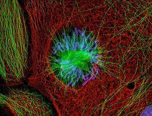 newscientist's tweet photo. Chemistry #Nobel2014: the creation of the NANOSCOPE http://t.co/CSYyutm0An http://t.co/LPE5xnUQXz