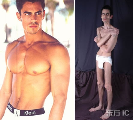 Desahogada's tweet photo. Todavía no asimilo la historia de este modelo que murió por culpa de la anorexia http://t.co/up6rY6zFcW