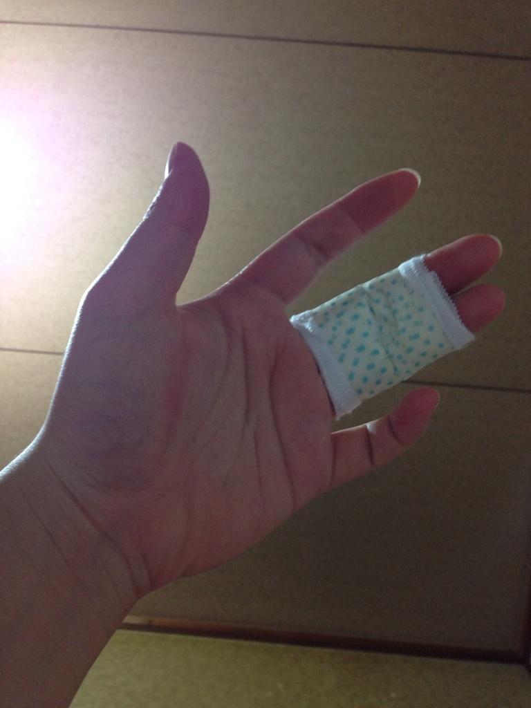 芋娘 No Twitter 今日突き指したんだけどテーピングなくて 仕方なく白石コス用の包帯巻いて包帯止めないからその上からマスキングテープぐるぐるした めちゃなんか かわいい Http T Co 8jxzdkvret 芋娘 No Twitter 今日突き指したんだけどテーピングなくて 仕方なく白石コス用の包帯巻いて包帯止めないからその上からマスキングテープぐるぐるした めちゃなんか かわいい Http T Co 8jxzdkvret