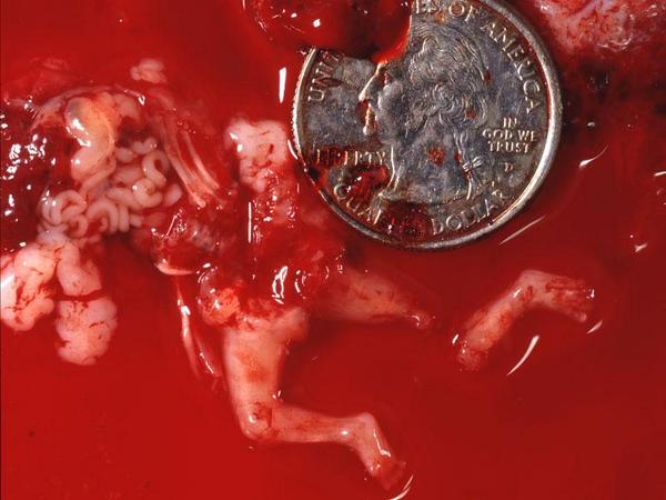 UnwantedAngels's tweet image. Their blood is in your hands!!