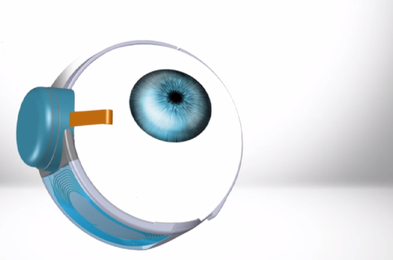 Embedded image permalink