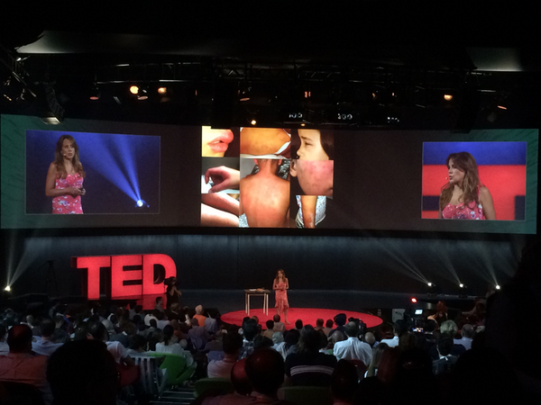 _camillacosta's tweet photo. .@IsabelHoffmann_ acaba de nos apresentar o protótipo (na foto, mostra as lesões da filha) #TEDGlobal http://t.co/xhceBZL1FW
