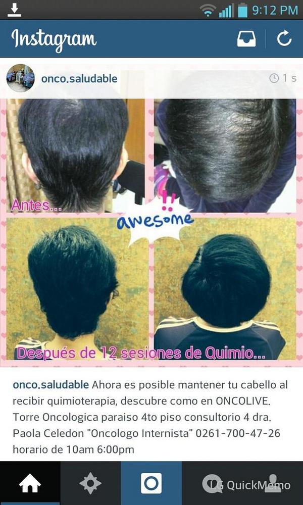 oncosaludable's tweet photo. Ahora es posible evitar la caida del cabello al recibir quimio terapia http://t.co/NZieZh8Ip2