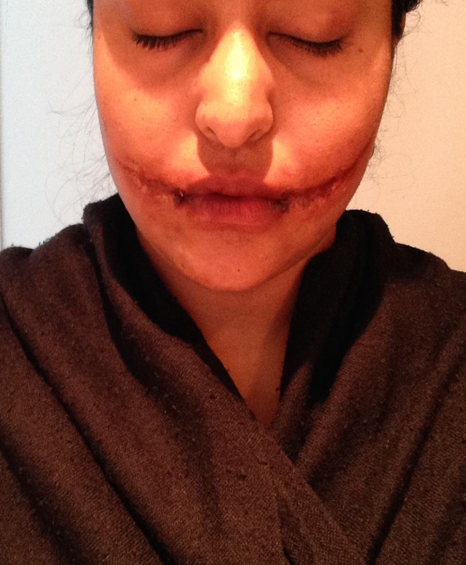SuhanHanifa on "Glasgow Smile: Stages of part 1 #makeup #sfx http://t.co/4ZjRQfNhyl" /