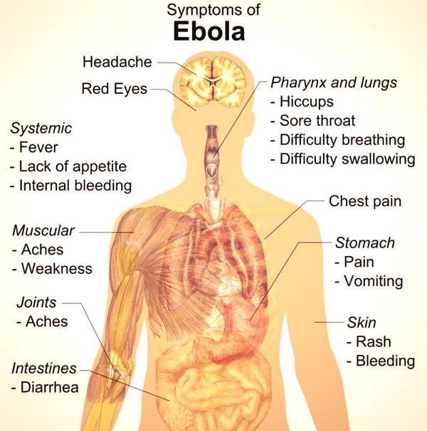 With the Ebola virus now spreading in the United States, it's important to know the symptoms. Retweet and pass it on.