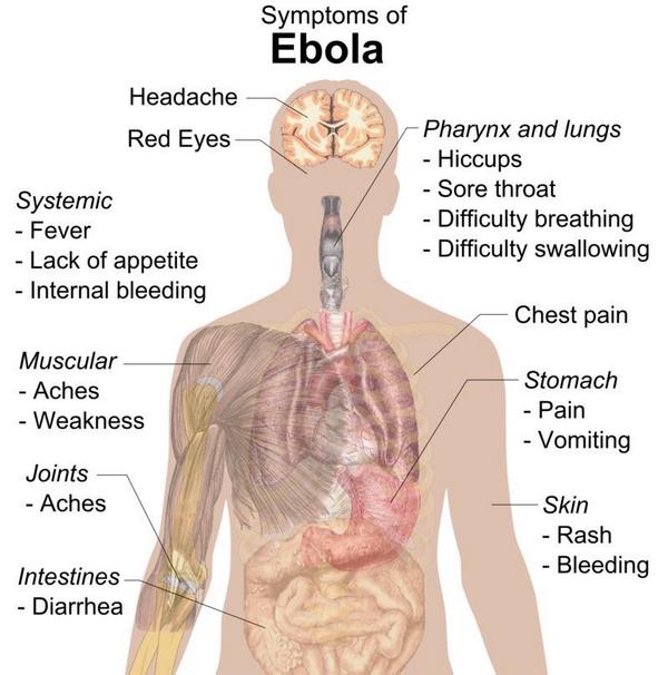 vdmsam's tweet photo. Ebola sound like a hangover http://t.co/BOvtv40apA