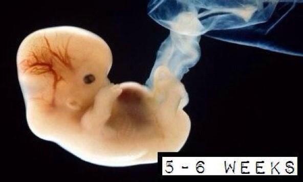 VidaPrimero's tweet photo. Cada bebé por nacer es uno de los nuestros. #UnoDeLosNuestros a las 5-6 semanas de vida: #QuieroNacer http://t.co/hpu4VJlc9J