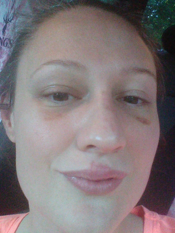 CassandraDrive2's tweet image. My goldiehawn is not as swollen!!!! #Botched