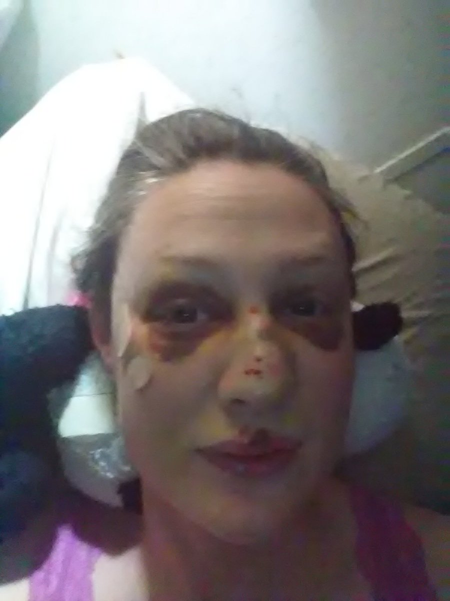 CassandraDrive2's tweet image. Wellstar Douglas hospital did this and more....@rikilindhome