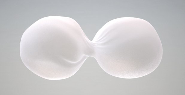 protesi al seno quanto durano
