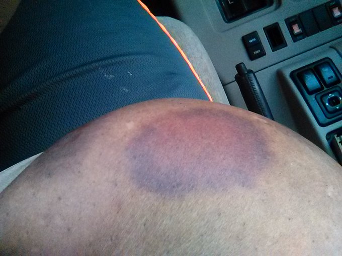 Crashed on my dirt bike man so glad to have huge boobies https://t.co/mP0yp5pWMK<a href="/tag/bustybeauty"class="tags"><span>&#35;bustybeauty</span></a>