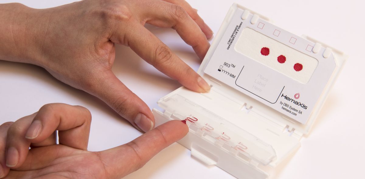 startuptickerCH's tweet image. DBS System closes CHF2.5 million financing round, attracts Swiss pension fund as an investor #medtech #bloodsamples startupticker.ch/en/news/may-20…