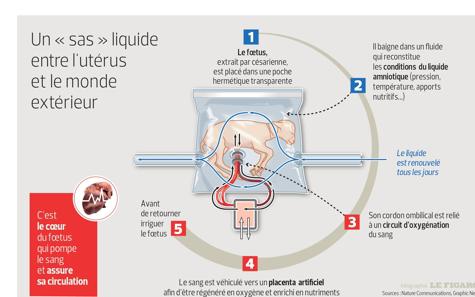 Obstétrique Hashtag On Twitter - 