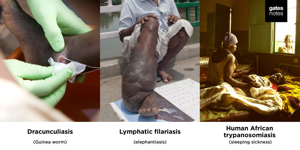 Taima2007's tweet photo. Yes, these pictures are disturbing. But the diseases that disfigure people like... https://t.co/aLEPqsDhTO by #BillGates via @c0nvey https://t.co/bGflsbmXn9