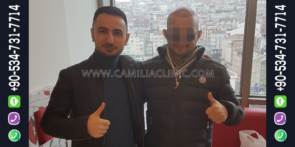 abdalkaderkhder's tweet photo. #زراعة_الشعر في #تركيا
 #كاميليا_كل��نك نستخدم أحدث ما توصلت إليه التكنولوجيا في... https://t.co/yR9BNyY8Wv by #tktka_ksa via @c0nvey https://t.co/31JdcJwrvK