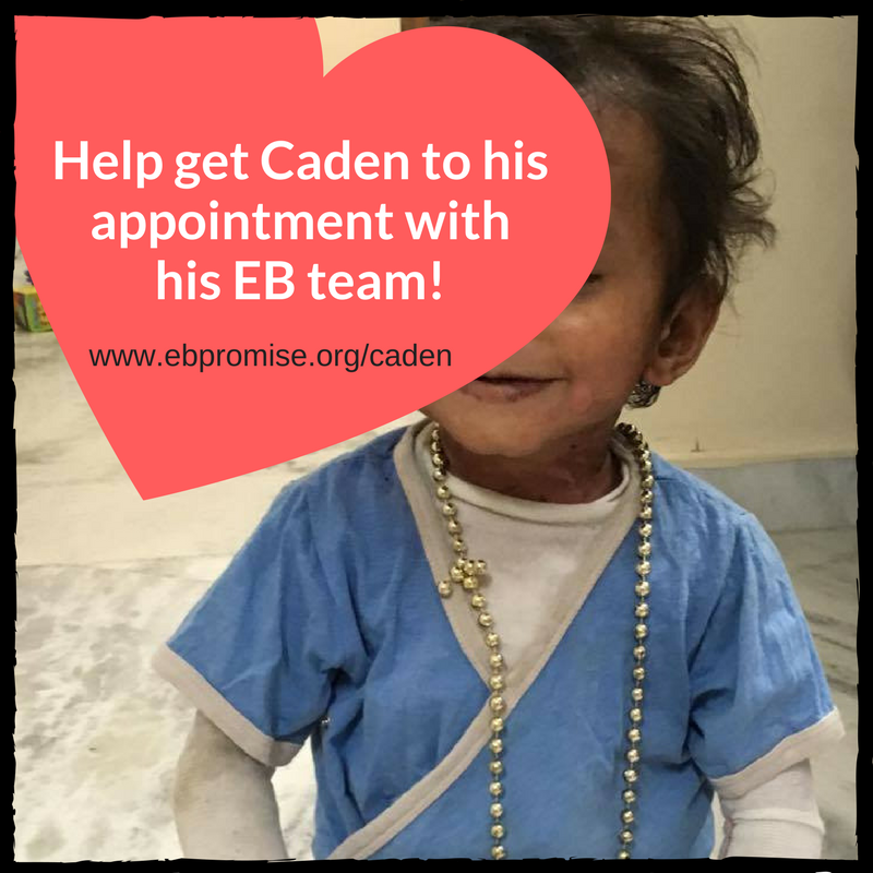 EbPromise's tweet photo. Caden's life was saved by his EB team &amp; it's time for his followup! Help get him there: https://t.co/Ir1T9vFk7l #eb #epidermolysisbullosa https://t.co/kQVsA2l47F