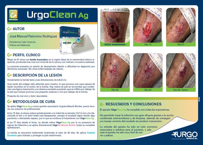 Ulcerasnet's tweet photo. Caso clínico mujer de 91 años herida traumática m.inferior tratada con #UrgoCleanAg @UrgoMedical_es https://t.co/pmqEyIH7WO