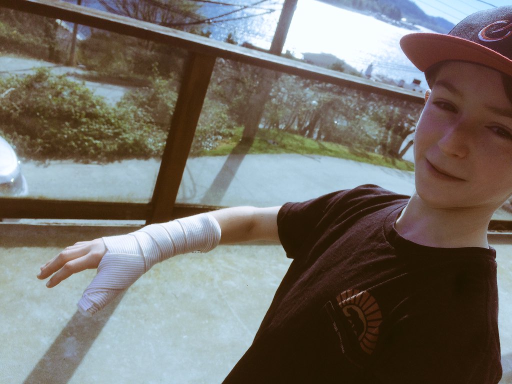 DERacing3's tweet photo. @lief.rodgers came away with the win yesterday but got bit by the post race dirt jumps. Broke thumb. https://t.co/2TK0oEKQE4