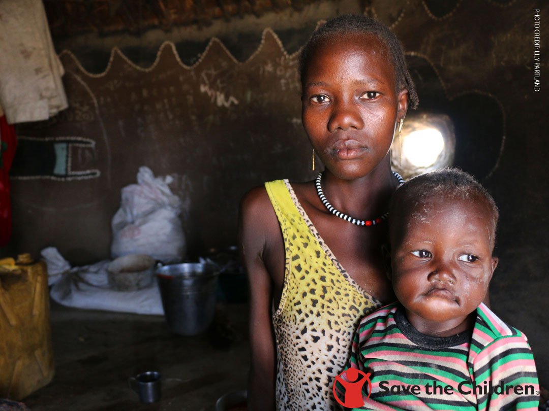 1-yr-old Tut* has been malnourished for 3 months. Learn about our response to the Hunger Crisis &amp; how you can help: ow.ly/w4xK30b8f4q