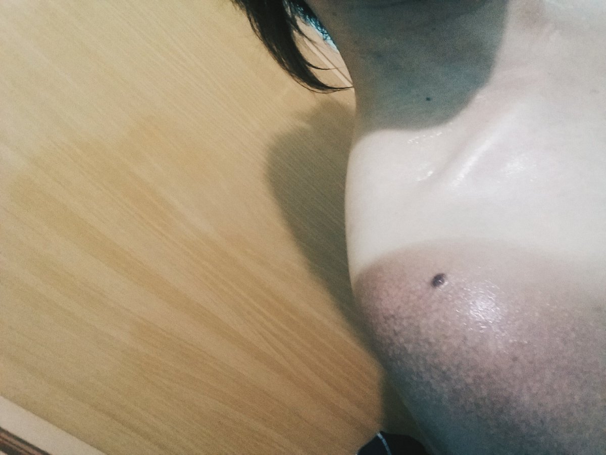 nethvillarba's tweet photo. #Sunblock #UseSunblock #YoureSoStupidSelf #NotGonnaDoItAgain
I swear this is the moat stupidest thing I have ever done. https://t.co/YxCeZaRXbB