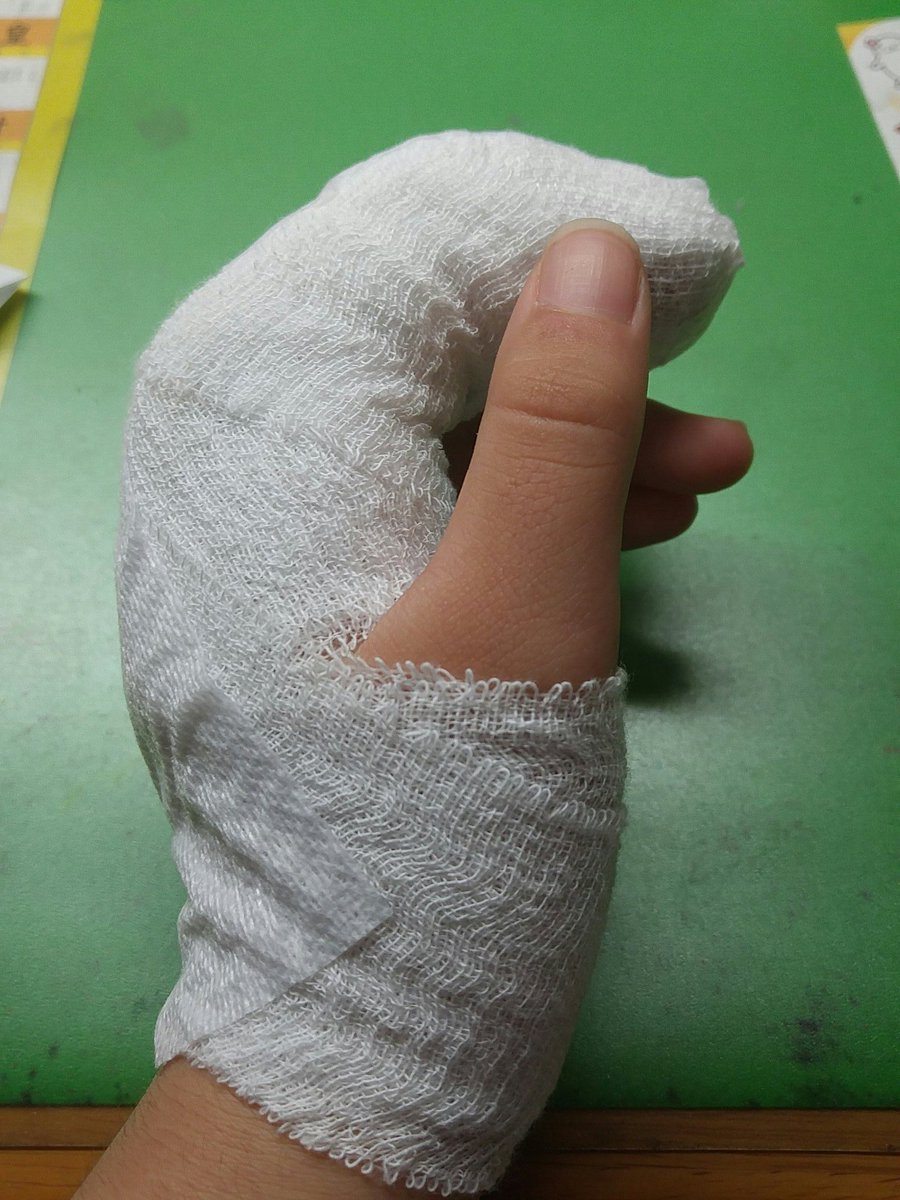 突き指 病院 突き指 病院