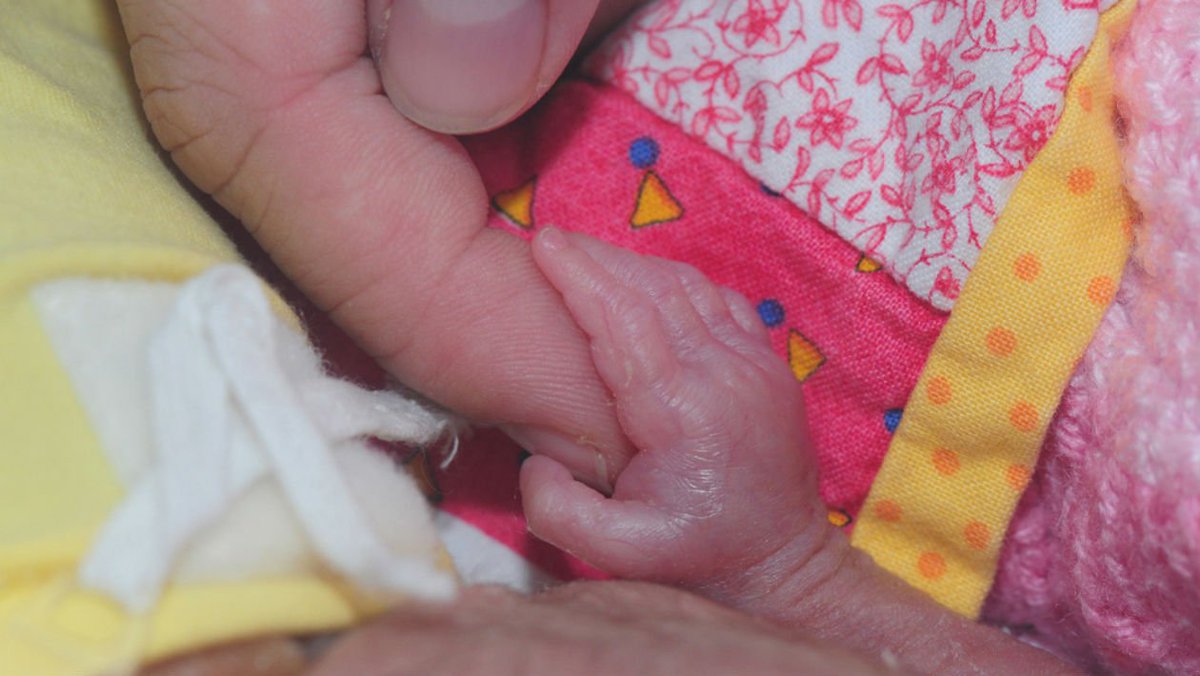 Resultado de imagem para Útero artificial poderá revolucionar cuidado de bebés prematuros