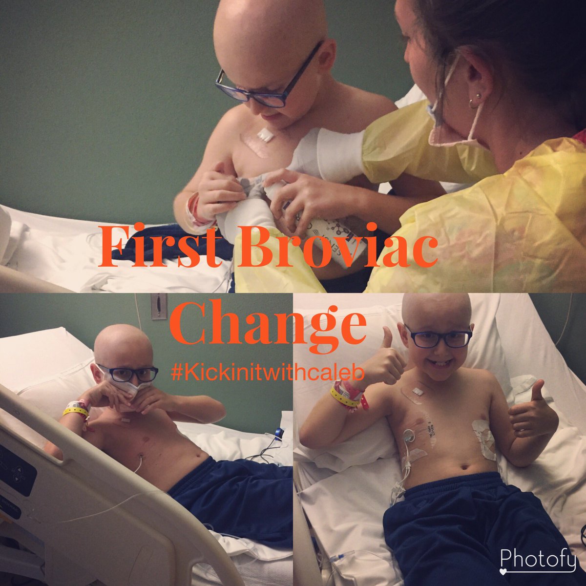 HelpCureCaleb's tweet photo. Caleb had his first broviac change this week https://t.co/QMnLx4kXjy