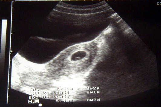 PezzEvans's tweet photo. Apenas vas creciendo en mí y ya Te amo #FirstEco https://t.co/BYBnRvE1Hz