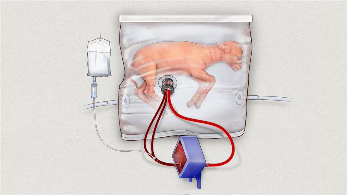 stefaniei's tweet image. Scientists have developed an 'artificial womb' that holds promise for premature newborns. wsj.com/articles/artif… via @WSJ @ellie_kincaid