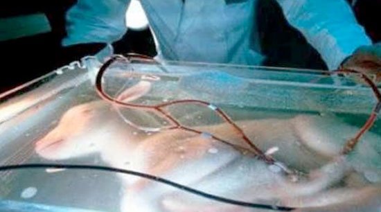 CMILANOTICIA's tweet image. Un #ÚteroArtificial mantiene con vida a fetos de animales prematuros bit.ly/2piE5IM