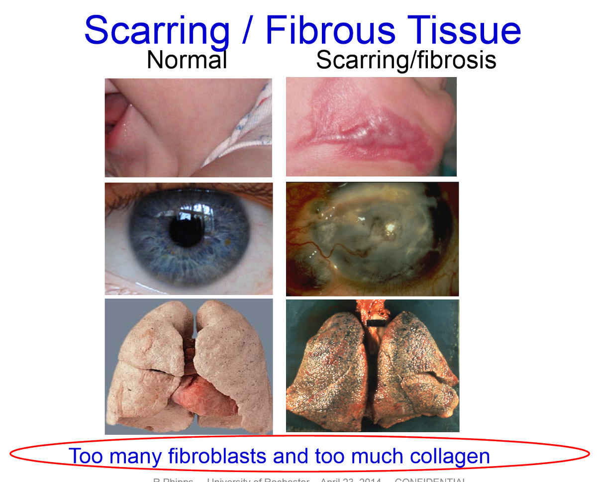 Seeking an experienced partner for development of anti-scarring technology. Please contact us. bit.ly/2q2Z9Ek