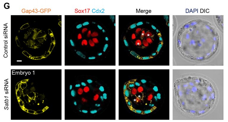 Development (@dev_journal) on Twitter photo Regulating cell fate in the early embryo with the chromatin modifier Satb1, from <a href="/MZG_Lab/">Zernicka-Goetz Lab</a> #OA dev.biologists.org/content/144/8/… Regulating cell fate in the early embryo with the chromatin modifier Satb1, from <a href="/MZG_Lab/">Zernicka-Goetz Lab</a> #OA dev.biologists.org/content/144/8/…