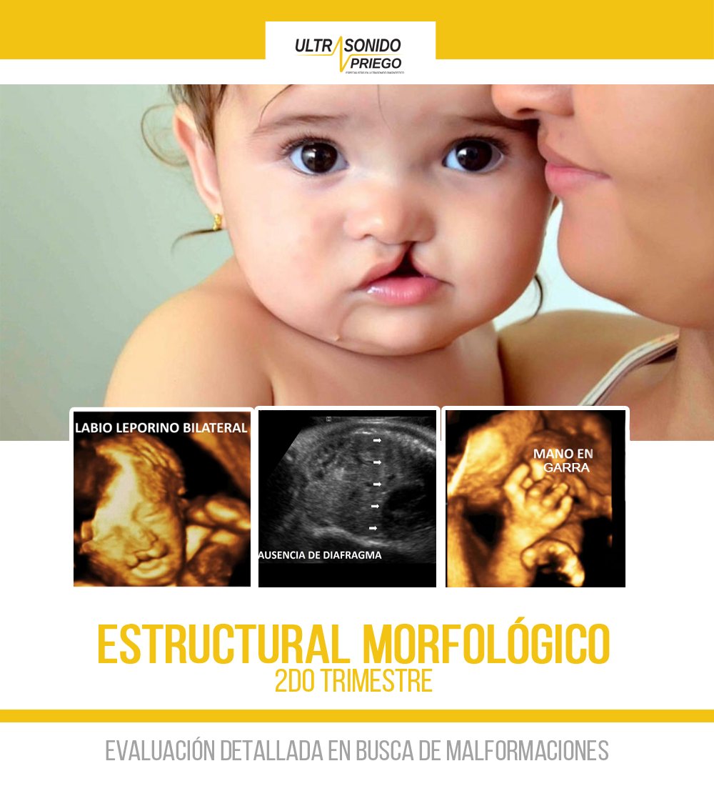 Eco Morfologico A Las Cuantas Semanas Se Hace Ultrasonido