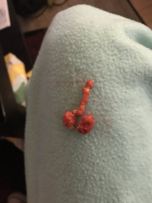 Cheetoh dick https://t.co/EREXzrAwpx