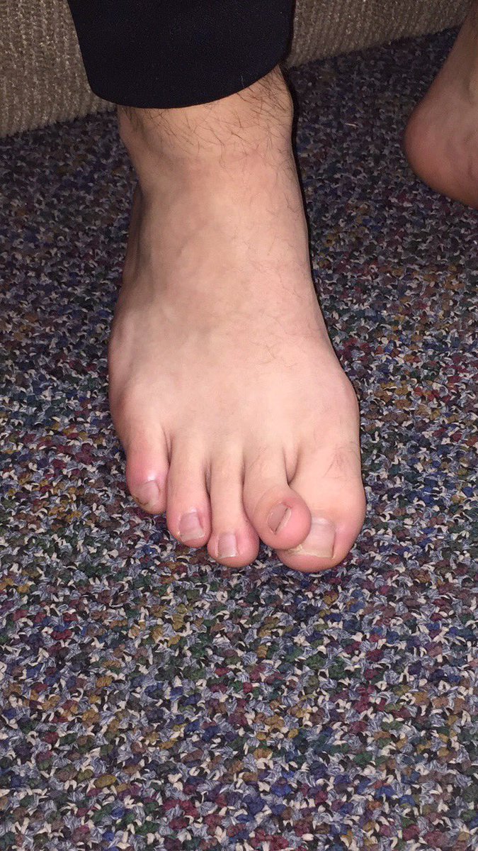 J_Walsh_14's tweet photo. Which foot would you rather have Like for Left (Nic) Retweet for right (Ty) https://t.co/KOI3Ks4FjQ