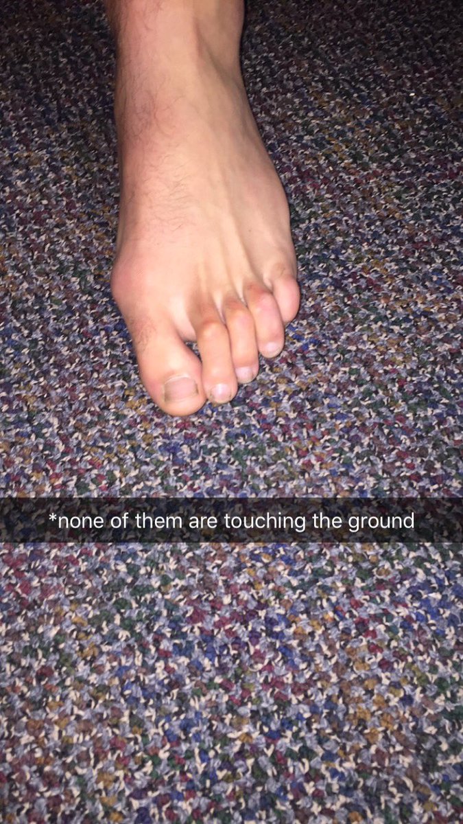 J_Walsh_14's tweet photo. Which foot would you rather have Like for Left (Nic) Retweet for right (Ty) https://t.co/KOI3Ks4FjQ