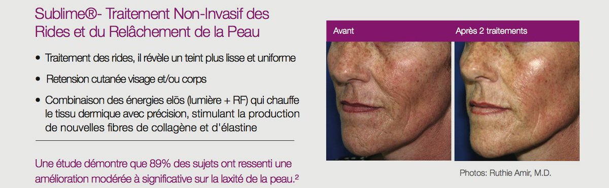 CandelaFrance's tweet photo. Découvrez la semaine prochaine lors du congrès de l'AMME à Arcachon, nos traitements en live #ElosPlus ! https://t.co/tRuolUG8Og