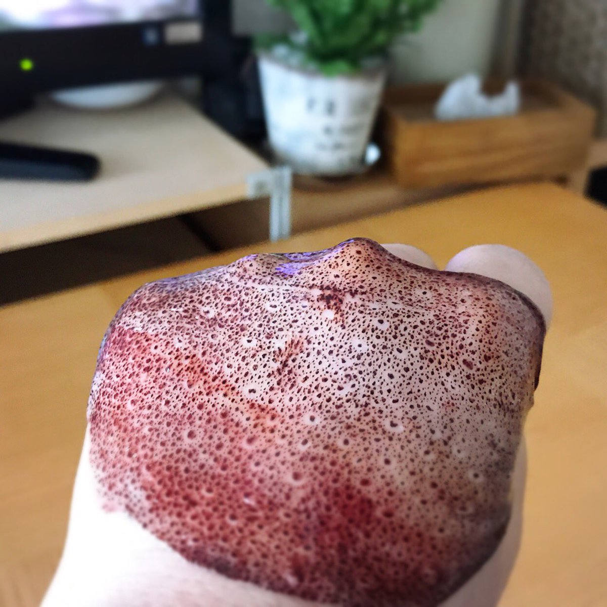 とっㄘん V Twitter ヤリイカ の皮を剥いだら 皮膚みたいだったので手の甲に ひっつけてみた 皮膚移植 とっㄘん V Twitter ヤリイカ の皮を剥いだら 皮膚みたいだったので手の甲に ひっつけてみた 皮膚移植