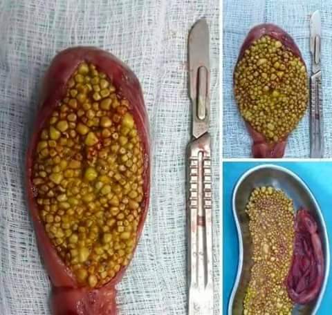 lora_fecc's tweet image. I can&apos;t imagine pain #MyEMSday